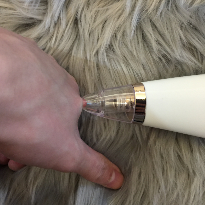North Elara Blackhead Removal Device